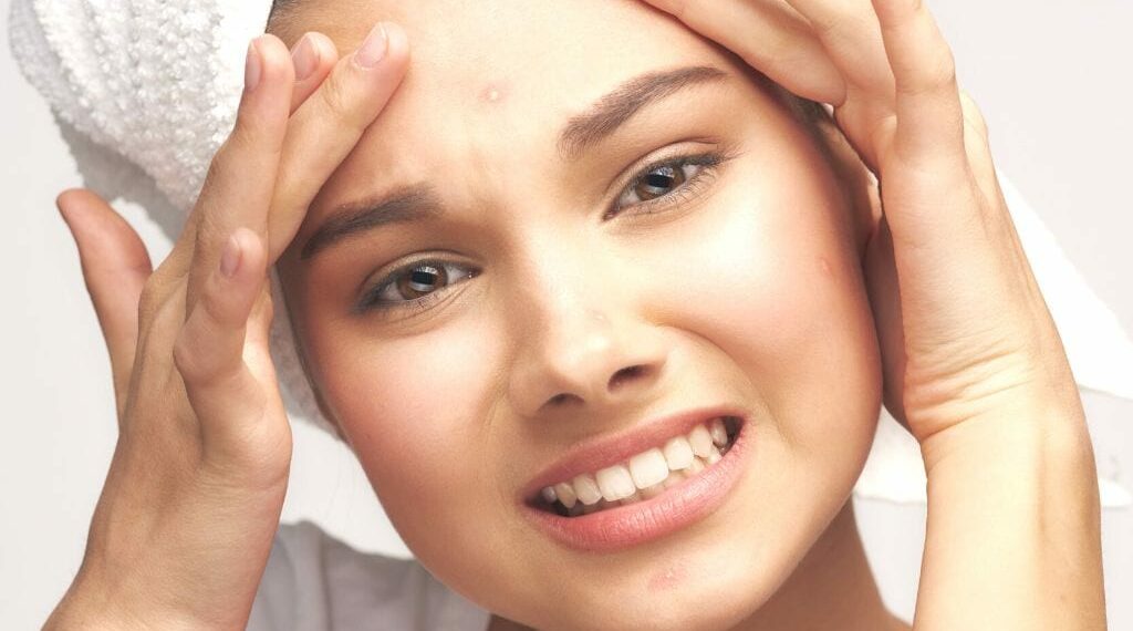 അടുക്കളയിലുണ്ട് മുഖക്കുരുവിനുള്ള പൊടിക്കൈകൾ