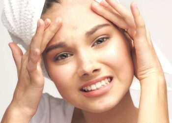 അടുക്കളയിലുണ്ട് മുഖക്കുരുവിനുള്ള പൊടിക്കൈകൾ