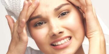 അടുക്കളയിലുണ്ട് മുഖക്കുരുവിനുള്ള പൊടിക്കൈകൾ