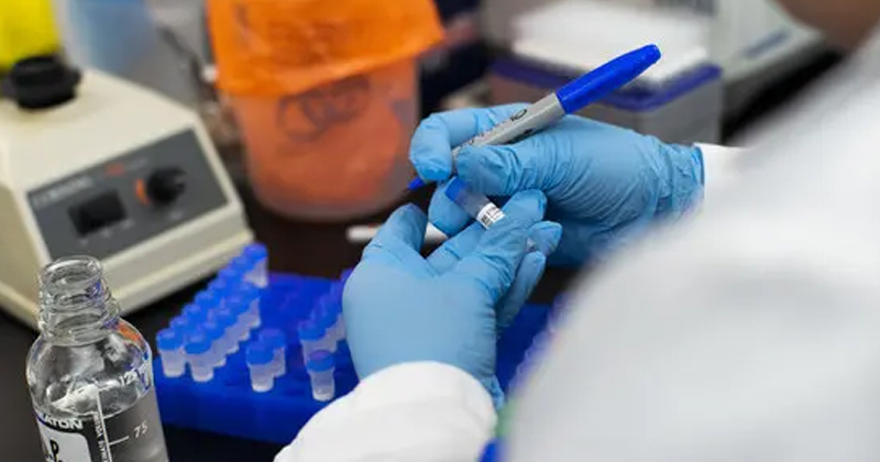 നിപ; ഡോക്ടർ ജ്യോതികുമാറിന്റെ ആ സംശയം ശരിയായി