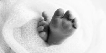 ന്യൂമോണിയ മാറ്റാന്‍ പിഞ്ചുകുഞ്ഞിന്റെ ശരീരത്തില്‍  ഇരുമ്പുദണ്ഡ് പഴുപ്പിച്ച് പൊള്ളിച്ചു