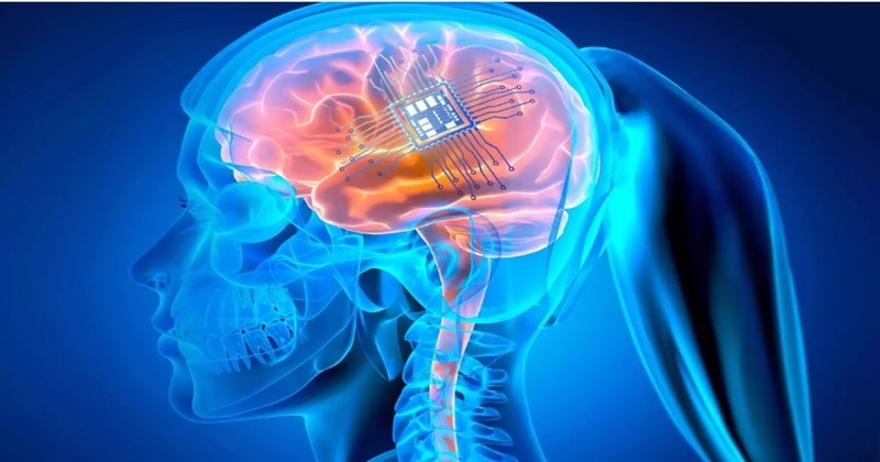 ഇനി നിങ്ങളുടെ ചിന്തയിലൂടെ ഫോൺ, കമ്പ്യൂട്ടർ എന്നിവ നിയന്ത്രിക്കാം; തലച്ചോറില്‍ ആദ്യത്തെ ഇലക്ട്രോണിക് ചിപ്പ് ദൗത്യം വിജയകരമെന്ന് ന്യൂറാലിങ്ക്