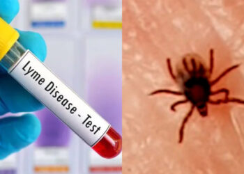 അത്യപൂർവമായ ലൈം രോഗം റിപ്പോർട്ട് ചെയ്തു; രോഗഭീതിയിൽ എറണാകുളം