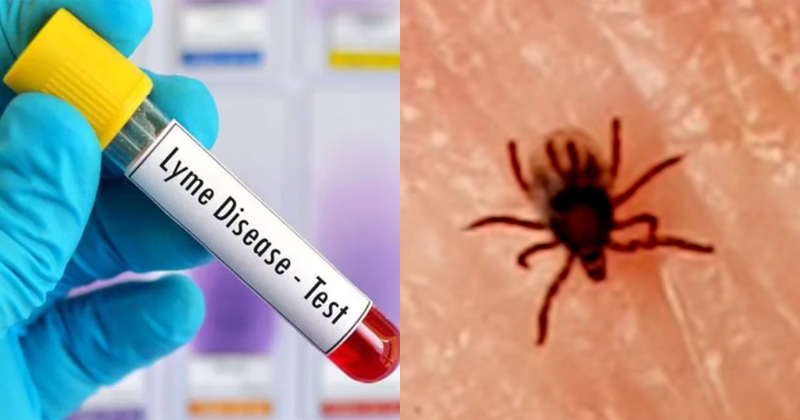 അത്യപൂർവമായ ലൈം രോഗം റിപ്പോർട്ട് ചെയ്തു; രോഗഭീതിയിൽ എറണാകുളം