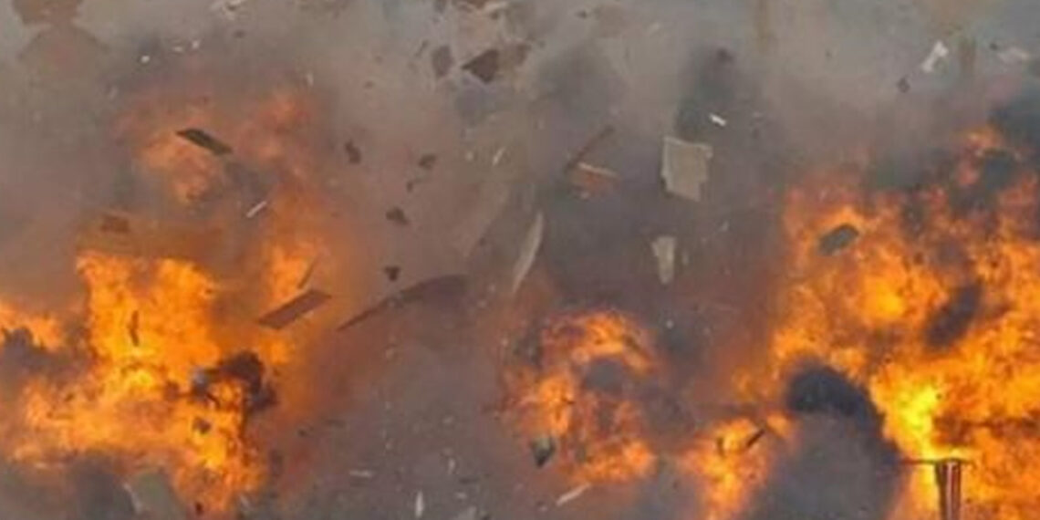 നാടൻ ബോംബ് നിർമാണത്തിനിടെ പൊട്ടിത്തെറി; 17കാരൻ്റെ രണ്ട് കൈപ്പത്തിയും നഷ്ടപ്പെട്ടു