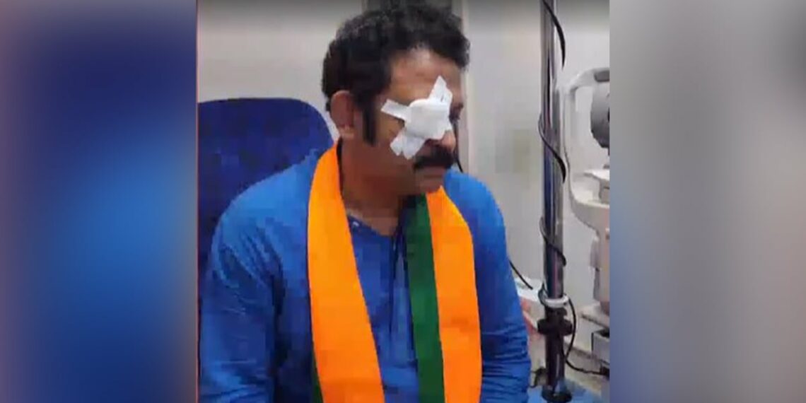 കൊല്ലം എൻഡിഎ സ്ഥാനാർഥി കൃഷ്ണകുമാറിന് പ്രചാരണത്തിനിടെ പരിക്ക്