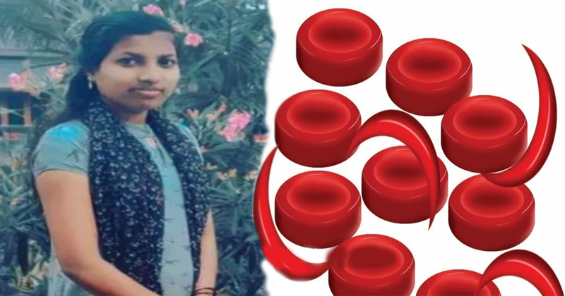 അരിവാൾ രോഗം: അട്ടപ്പാടിയിൽ യുവതി മരിച്ചു