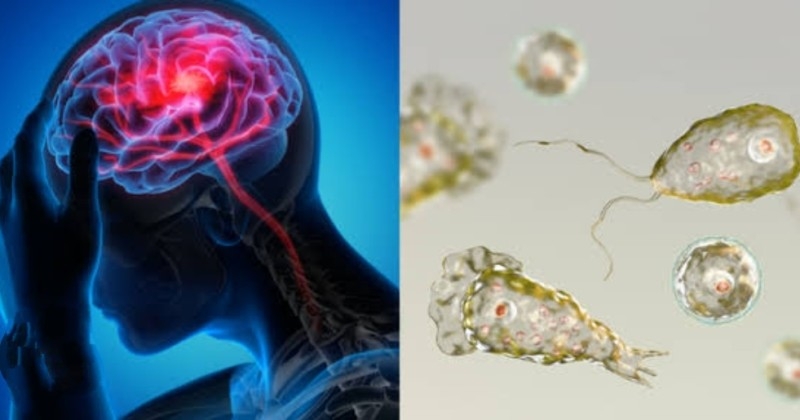 അമീബിക് മസ്തിഷ്‌കജ്വരം;  നാല് കുട്ടികളുടെ പരിശോധന ഫലം നെഗറ്റീവ്