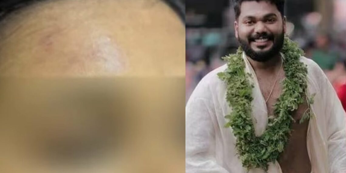 ‘മൊബൈല്‍ പിടിച്ചുവച്ചു, പുരുഷന്മാരുടെ ഫോൺ നമ്പറുകൾ ബ്ലോക്ക് ചെയ്തു’; നേരിട്ടത് കൊടിയ മർദ്ദനമെന്ന് നവവധു