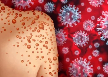 എംപോക്സ് വ്യാപന ഭീഷണി; രാജ്യത്ത് ജാ​ഗ്രത നിർദ്ദേശം – ആശുപത്രികൾക്കും വിമാനത്താവളങ്ങളിലും മുന്നറിയിപ്പ്