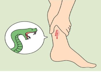 പാമ്പുകടിയേറ്റുള്ള മരണത്തിൽ വൻ വർധനവ്; തീവ്ര കർമ്മ പദ്ധതിയുമായി കേന്ദ്രം